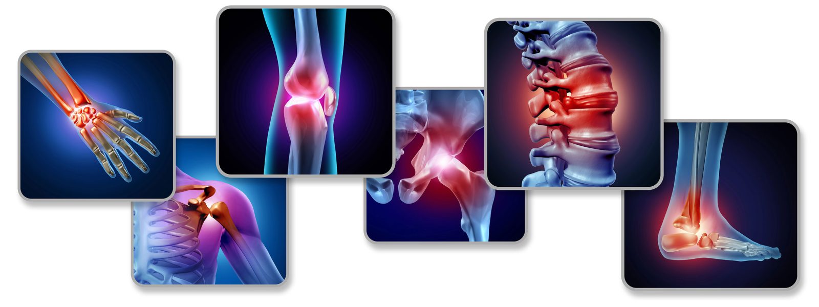 Pain of the joints concept as skeleton and muscle anatomy of the body with a group of sore joints as a painful injury or arthritis illness symbol for health care and medical symptoms with 3D illustration elements.